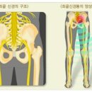 좌골신경통엔 발가락운동용구 듀트 이미지