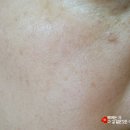 스템잇 이미지