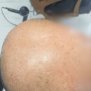 화성미용실김호증모가발 이미지