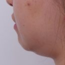 청담청초성형외과의원 이미지