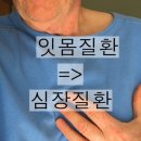 입냄새와 장내세균,성조숙증과 호르몬,잇몸질환과 치매,심장질환,여름철건강관리,흰설탕.황설탕,흑설탕,신생아,면역, 이미지