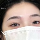 뷰티나게 | 까치산눈썹문신 고민 끝! 티 안 나게 예뻐져서 만족한 후기 데일리뷰티