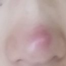 비에이성형외과의원