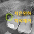 단대오거리 1번출구 앞 이미지
