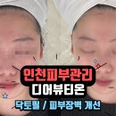 디어뷰티온 | 주안피부관리 디어뷰티온에서 닥토필 받은 후기