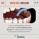 대구 자동차 유리복원 차 유리만 수리하는 돌 맞은 차 유리 때웁니다