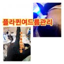 꼼플라