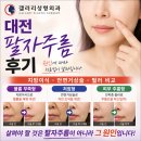 대전 팔자주름 후기｜원인에 따라서 지방이식·필러·안면거상술을 선택하세요, 갤러리성형외과