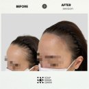 스칼프디자인센터 - 천안시 서북구 번영로 201 | 스칼프디자인센터