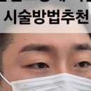 플러피비네일 이미지