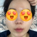 여울 | [부산/부산진구] 서면여드름압출 전문 여울에스테틱 방문후기 여드름전문 서면에스테틱 추천 문제성피부