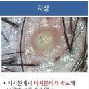 피아체헤어