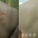 리유한의원 네이버블로그