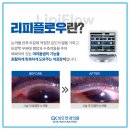 양재성모안과의원 이미지