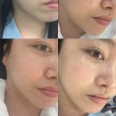 [봉천동피부관리] 피지 모공 홍조 피부 클렌징 습관부터 고쳐주는 다드림 피부연구소 솔직 후기
