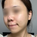 제이코스메틱 - 서구 화개1로 8 | 메디제이 더블유크림 라이트 3주 사용 솔직 후기 / 수부지 트러블크림