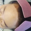 퀸헤어라인 이미지