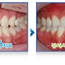 나무 치과기공소 이미지