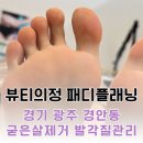의정엔 | 광주 경안동 뷰티의정 발각질관리 패디플래닝 강추
