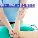 미금역 류마티스내과:: 재발성 류마티스 관절염 원인과 증상 이미지