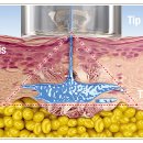 메디케이 이미지