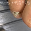 베티네일 이미지