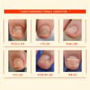 라이프케어스 이미지