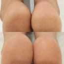 메이크업닻별 | 대전패디플래닝 관리 원신흥동 메이크업닻별 각질제거 후기