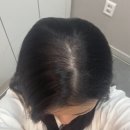웰킨두피탈모센터시흥배곧 | [내돈내산] 웰킨두피탈모센터 시흥배곧점 탈모관리 받고 너무 만족해서 적는 real 후기(여성탈모)