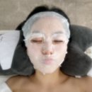 [서산] 서산 피부관리 박앤이 비립종 제거 후기