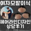 여자 모발이식 비절개 가격 헤어라인 교정 디자인상담 후기
