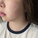 라디앙의원 | 구리피부과 인모드 브이라인 인생처음 인모드 후기 라디앙의원