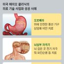 메이오 이미지