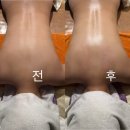 뷰티블르바드 | 청담에스테틱 연예인 슬리밍관리 유명한 뷰티블르바드 상체관리 받은 후기