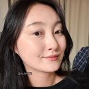 유태안「피곤한 사람 | 수술없이 비절개 아이백클리어로 피곤한 인상 개선! 눈밑지방재배치 후기