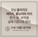 왜 강남 사람들은 써마지 대신 '국산 고주파'를 찾을까? 피부과 직원들은 다 아는 비밀 | 논현역 더...