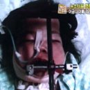 KBS2 뉴스타임 현장] ‘희귀 질환자’ 힘겨운 세상 싸움 이미지