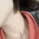 한마음내과의원 | 갑상선 세침검사 후기 비용 통증 (창원한마음병원)