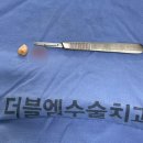 광주 사랑니 치과 후기 :: 상무지구 더블엠 매복사랑니 맛집 ㅇㅈ (+ 함치성낭종)