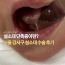 박소아과의원 | 신생아 설소대 시술 후기 | 서울 강서구 수술가능 병원