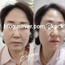 대구 입술 반영구 후기, 김홍뷰티 창백하고 흐릿한 입술에 생기 더하기