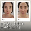 정관장달동점 | 울산 윤곽관리 플로라에스테틱 작은얼굴 삼산동 피부관리