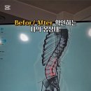 엠지테라피