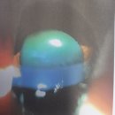 백내장 수술하고 2009년 8월에 가입한 실손의료보험 백내장 치료비 받을 수 있습니까? 이미지