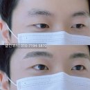청라대로 | 청라남자눈썹문신 내돈내산 후기 ( 비용은 얼마일까? )
