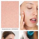 피부야 놀자 이미지