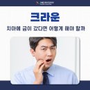 이센치과의원 | 동래구 치과 크라운 치료 시 반드시 알아야 하는 것은?