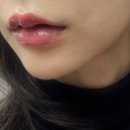에스테틱공간 강남역피부관리 추천, 예신 일상 중 뜨는 화장 잡는 뱀파이어필+림프마사지 솔직 후기