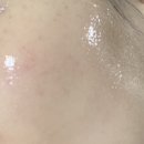 메디컬글로우 | [바노바기] 젤리앰플 캡슐앰플 광채앰플 비타 제닉 젤리 글로우 앰플 사용후기