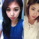 노블앤코성형외과 네이버블로그